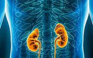 Centers for Dialysis Care Foundation Supports Care for Patients with Chronic Kidney Disease
