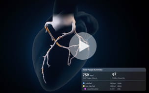 Artificial Intelligence at University Hospitals