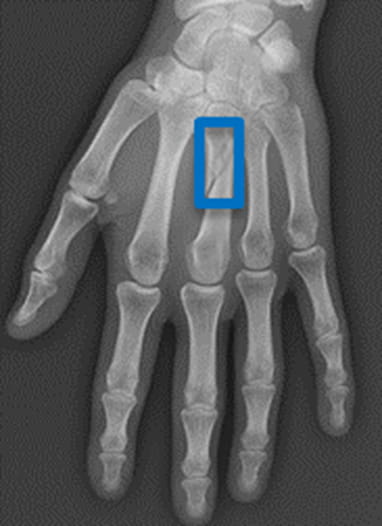 RadiCLE Collaborative Improves Radiology with AI